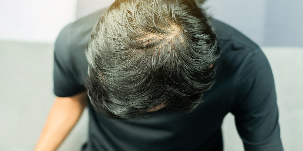articles/hair_whorl.jpg
