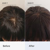 Superpower+ Advanced - Hair Densifying Scalp Serum