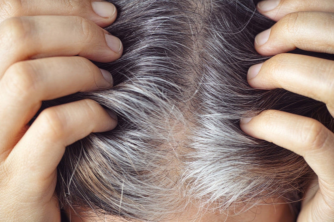 Why Is My Gray Hair Turning Yellow & Brassy?