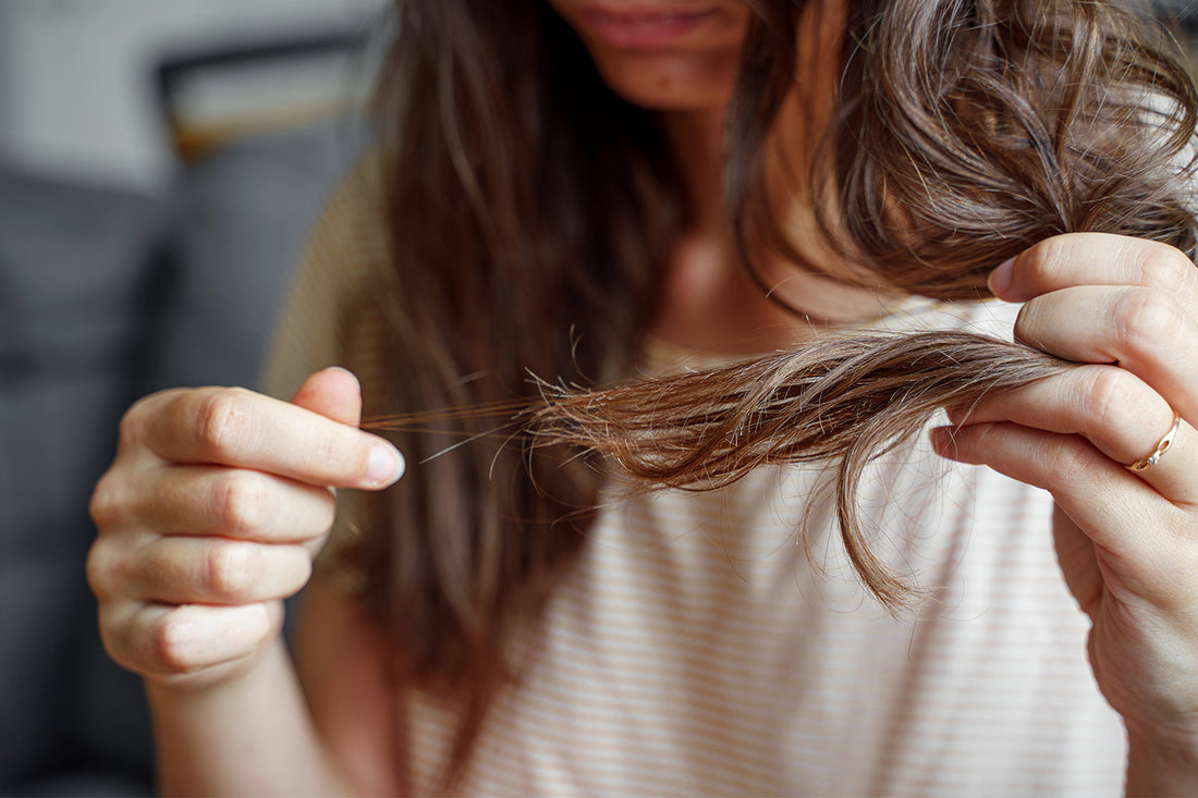 Which Vitamin Deficiency Can Cause Hair Loss?
