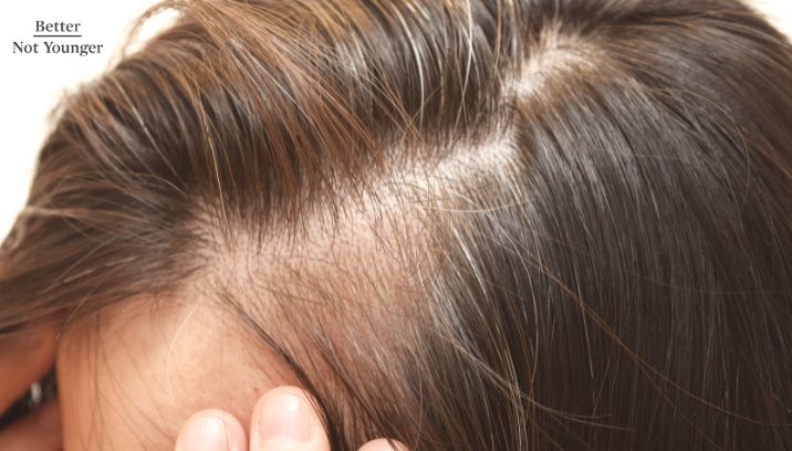 Top 10 of Ways Women Can Hide Thinning Hair in the Front 