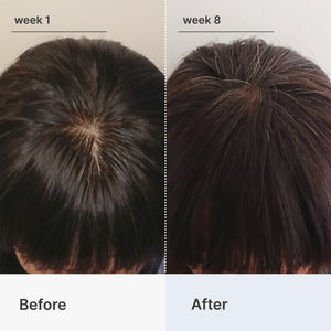 Hair Loss Starter Bundle