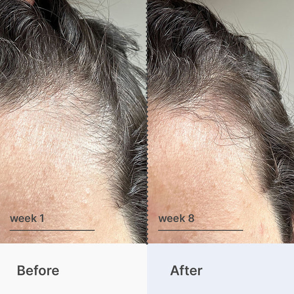 Superpower Fortifying Hair & Scalp Serum