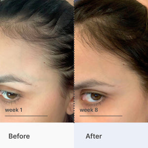 Superpower Fortifying Hair & Scalp Serum