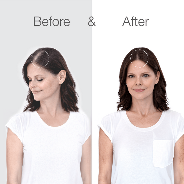 Superpower+ Advanced - Hair Densifying Scalp Serum