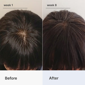 Superpower+ Advanced - Hair Densifying Scalp Serum